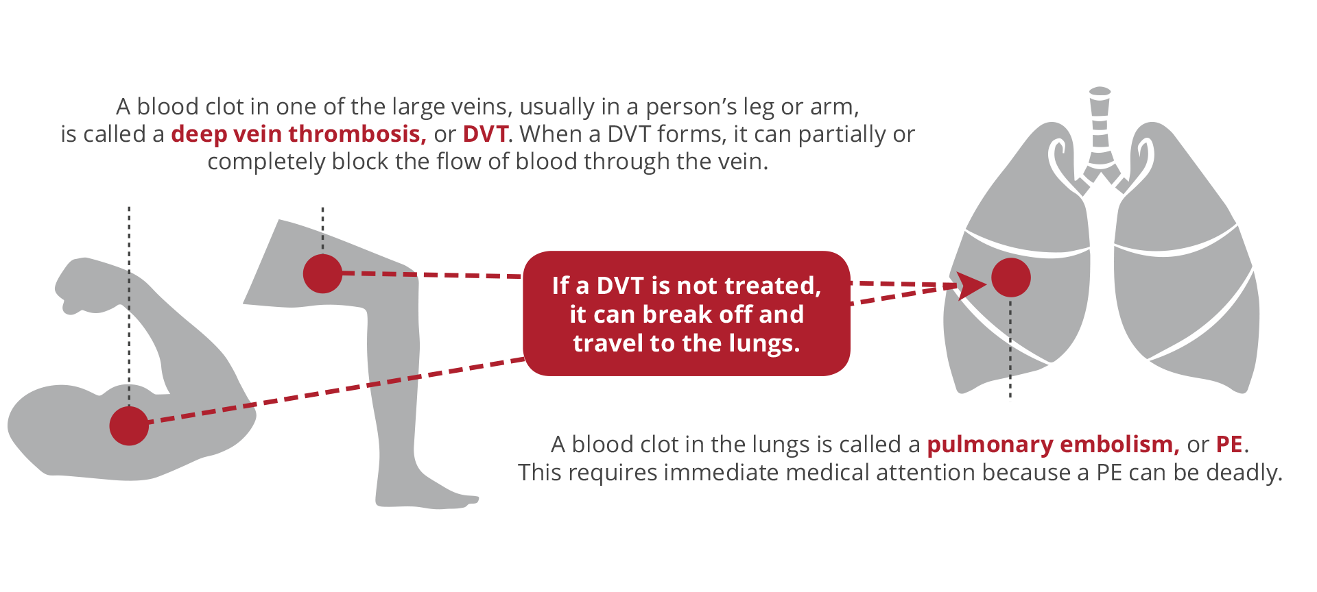 Understanding blood clots