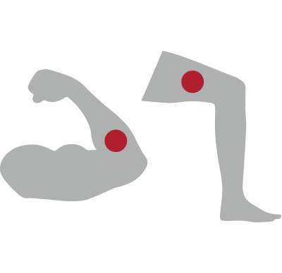 arm-leg-graphic Human arm and human leg