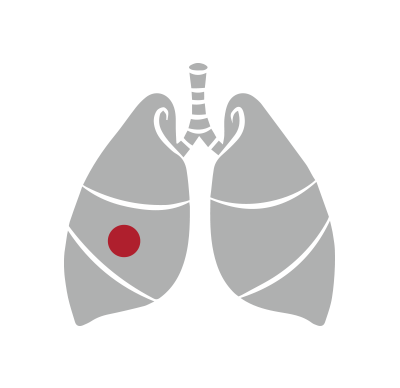 Human lung