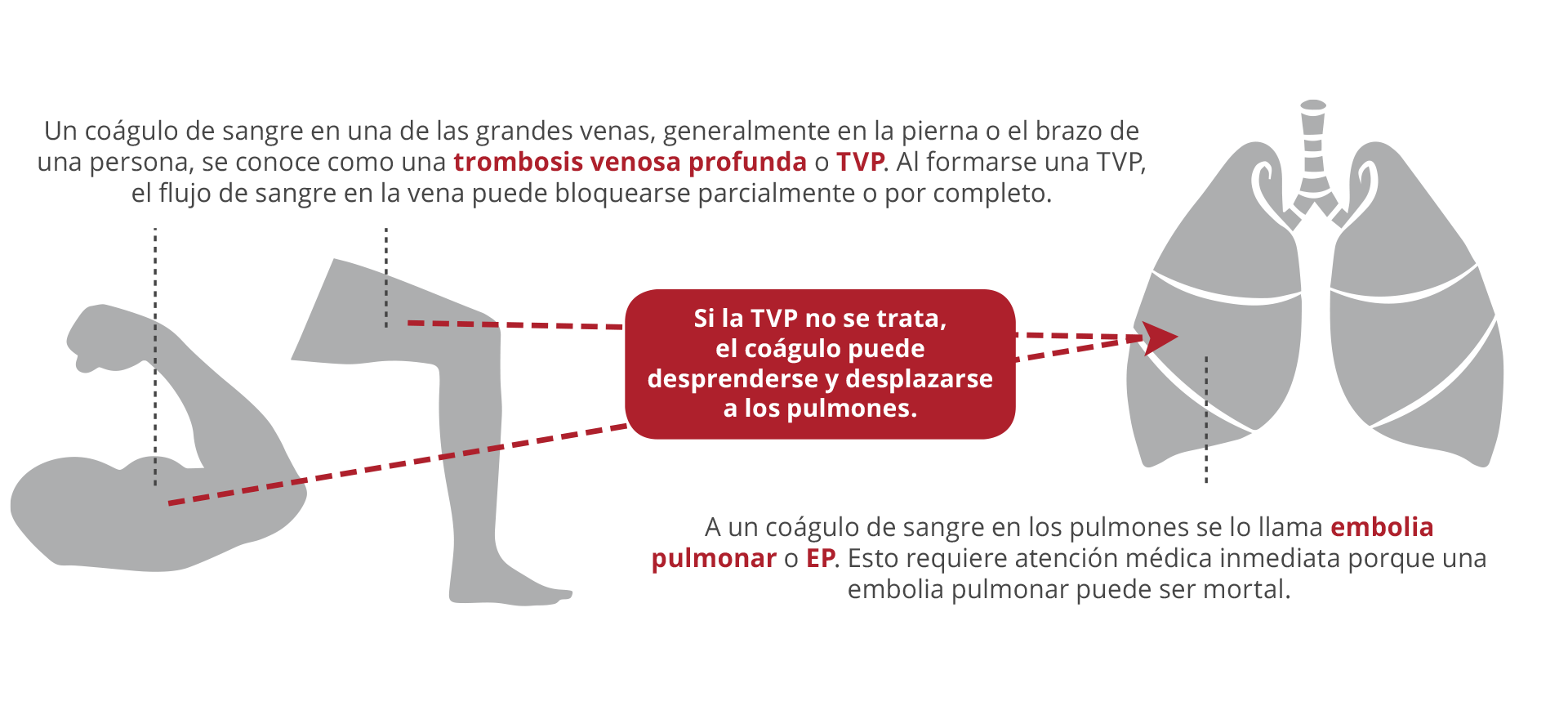 Saber sobre los coágulos de sangre