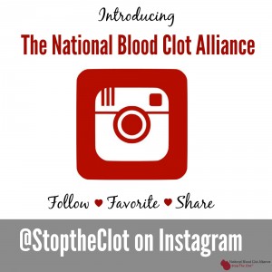 Introducing IG