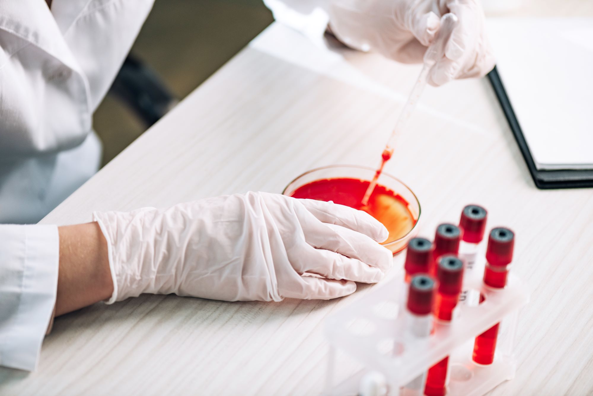 research into covid-19 and clotting