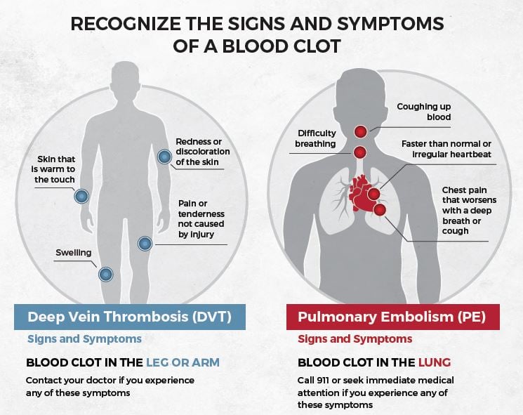 symptoms of clotting 