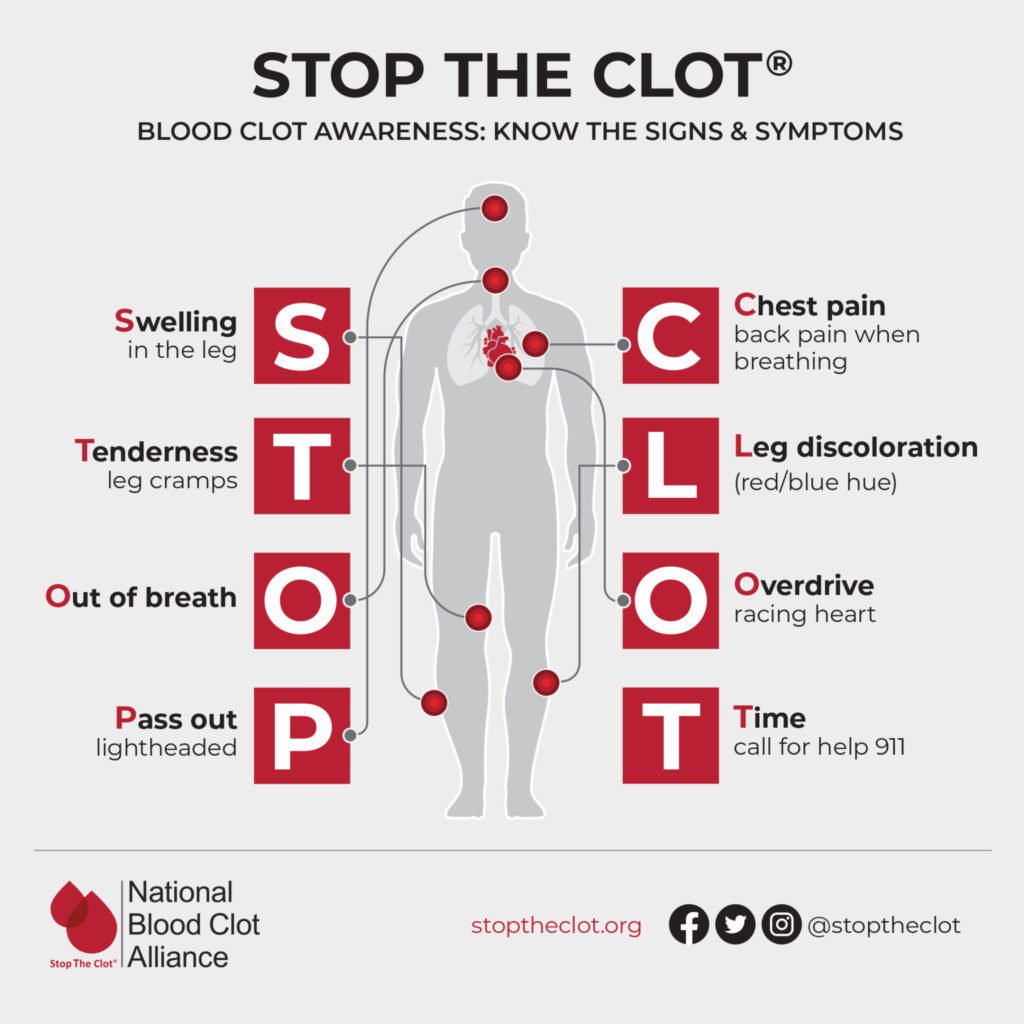 Signs And Symptoms Of Blood Clots Blood Clots
