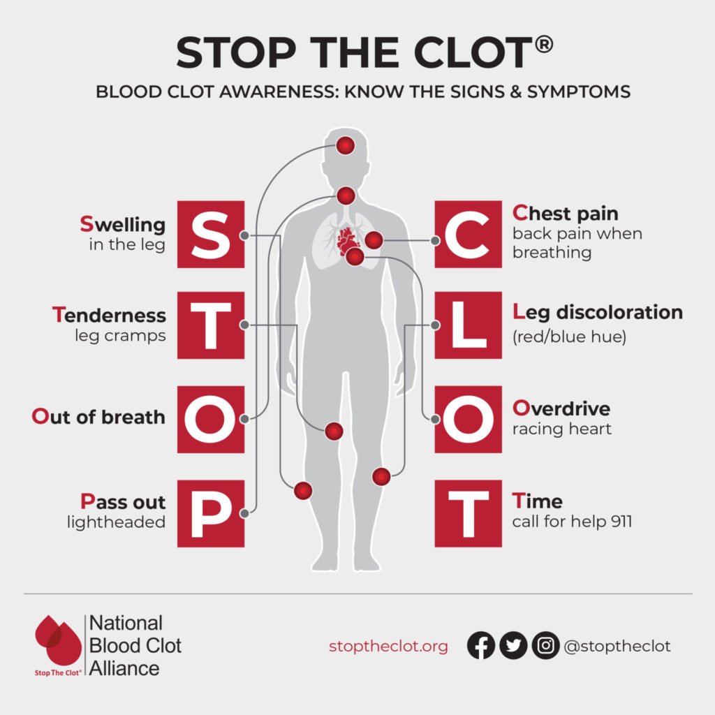 Signs and Symptoms of Blood Clots