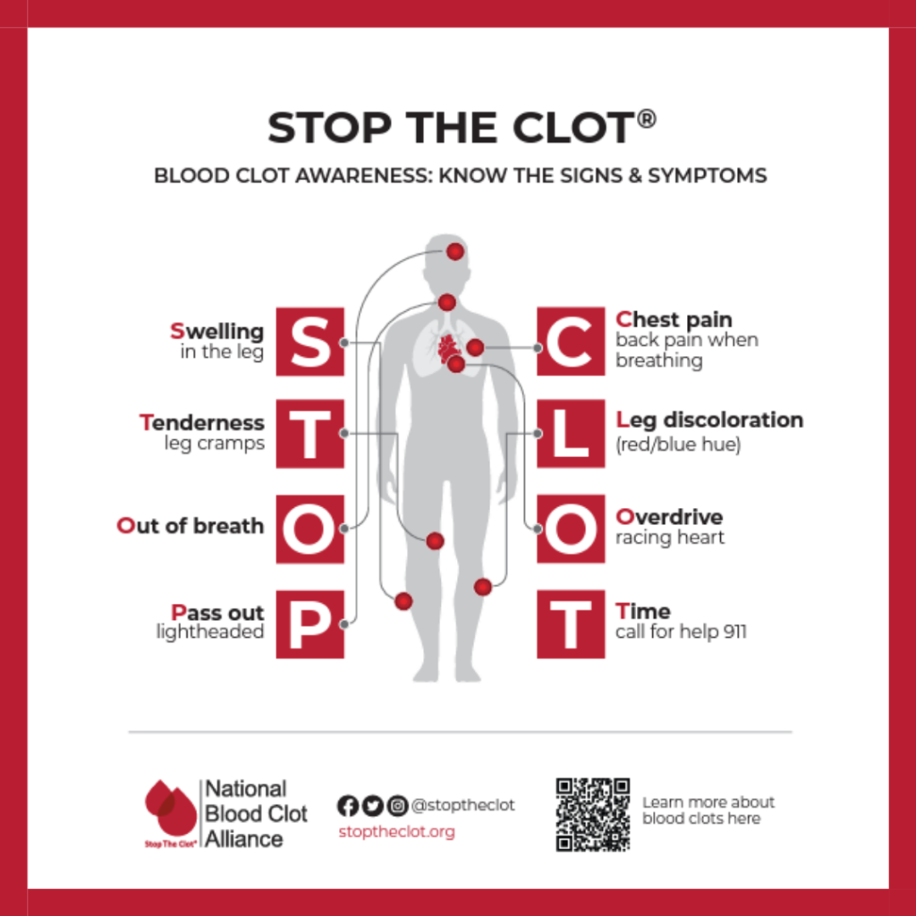 National Blood Clot Alliance STOP THE CLOT® infographic showing warning signs of blood clots, including leg swelling, tenderness, shortness of breath, fainting, chest pain, leg discoloration, and racing heart.