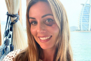 Emily J, a massive bilateral saddle pulmonary embolism survivor who collapsed in cardiac arrest on a long-haul flight at 33 after a DVT formed during 10.5 hours of immobility.