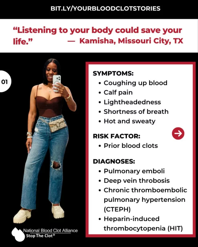 Kamisha developed her first DVT at age 15. Since then, she’s lost track of how many blood clots she’s experienced — despite taking anticoagulants and having zero known risk factors. 

After her most serious clotting incident in 2016 in which she was diagnosed with heparin-induced thrombocytopenia (HIT), she’s raising awareness of the signs and symptoms of blood clots and urging everyone to listen to their body.

🔗More stories at the link in bio.

#StopTheClot #StopTheClotStory #DVT #PE #CTEPH #HIT #BloodClotAwareness